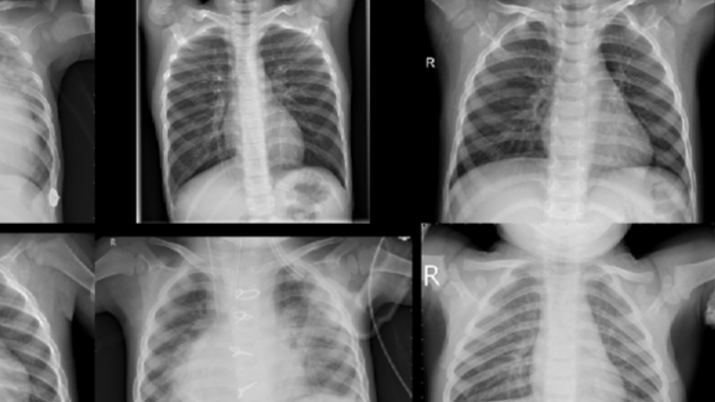 Kursus Jasa Skripsi Tesis Disertasi Matlab Citra Medis